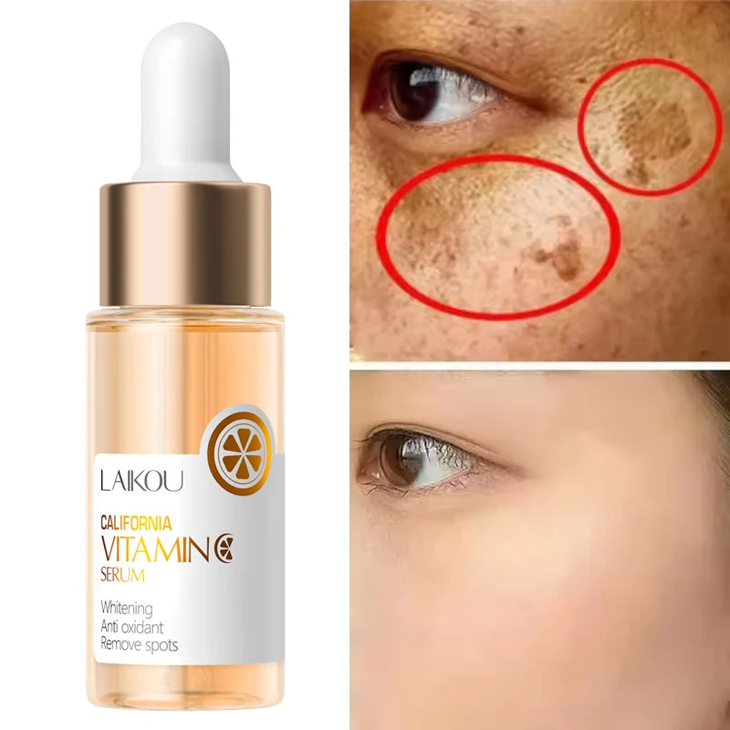 Vitamin C Whitening Serum Freckle Remove Essence Fade Pigmentation Melasma Dark Spots Corrector Repair Serum Korean Skin Care
