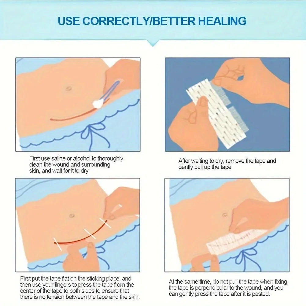 1PC Sterile Strip First Aid Travel Wound Skin Closures Medical Surgical Adhesive