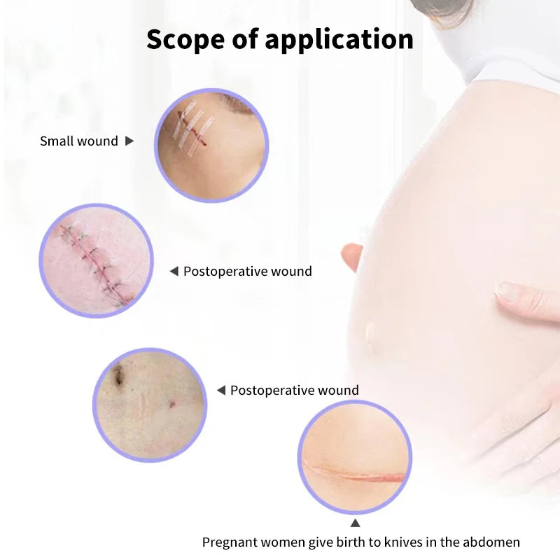 5 Strips Wound Skin Closure Strips Postpartum Wound Repair Cosmetic Surgery Strip Adhesive Medical Suture Free Surgical Tape