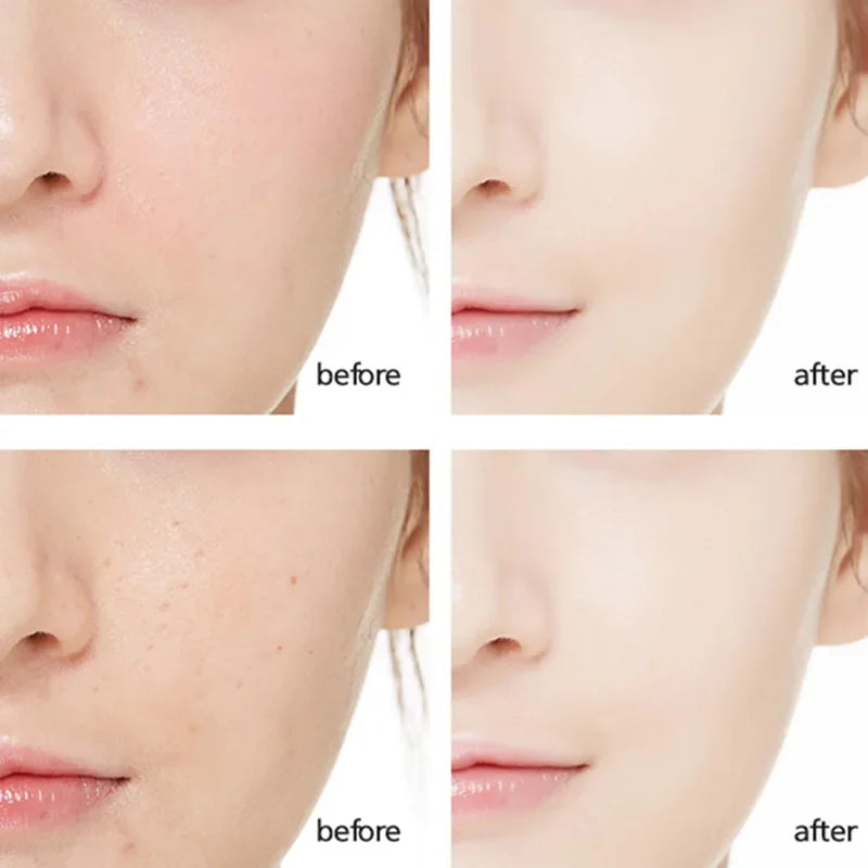 30/60g new Retinols Anti Aging Face Cream Moisturizing Wrinkle Remover Collagen Hyaluronic Acid Creams Skin Care Cosmetic
