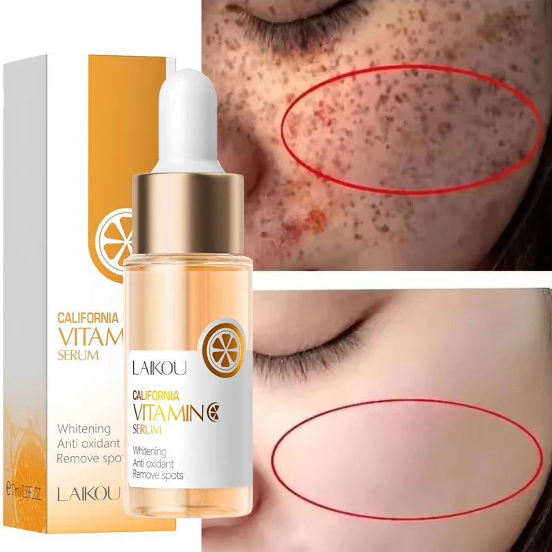 Vitamin C Whitening Serum Freckle Remove Essence Fade Pigmentation Melasma Dark Spots Corrector Repair Serum Korean Skin Care