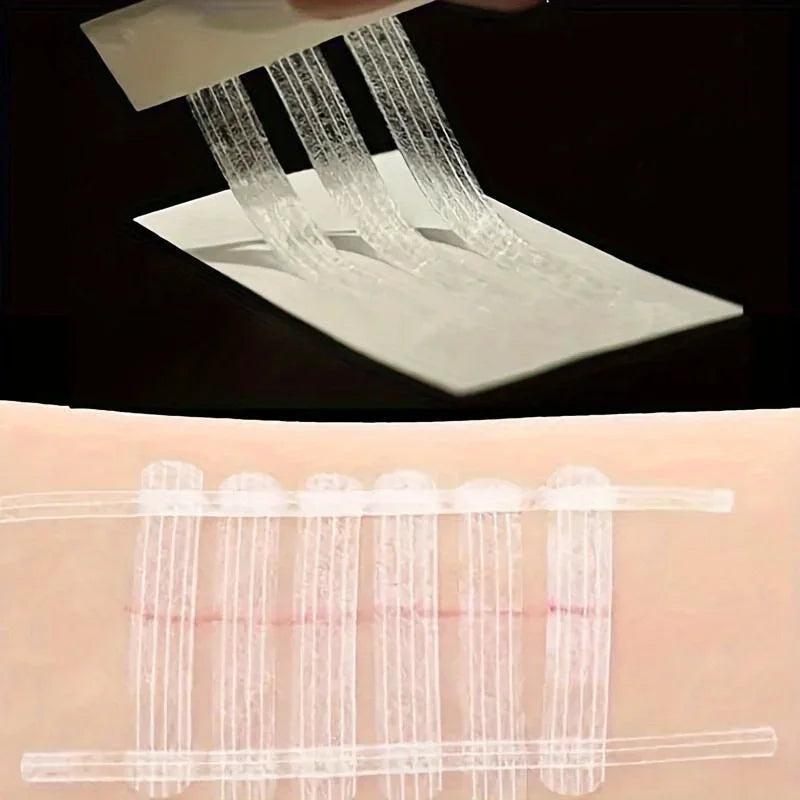 5 Strips Wound Skin Closure Strips Postpartum Wound Repair Cosmetic Surgery Strip Adhesive Medical Suture Free Surgical Tape